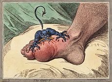 The_gout_james_gillray